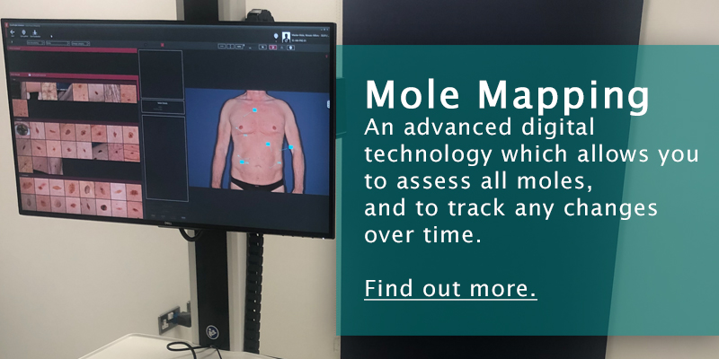 Mole Mapping